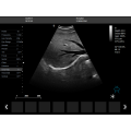 Ordenador portátil 3D y 4D Ultrasound Machine Price &amp; DAWEI DWC60 color Doppler